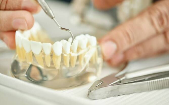 Porównanie koron pełnoceramicznych i innych rozwiązań protetycznych – co wybrać?