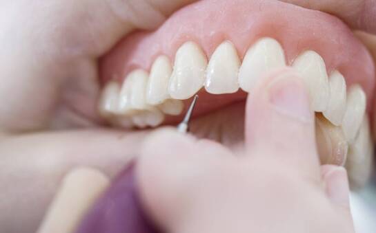 Rola periodontologii w zapobieganiu chorobom ogólnoustrojowym
