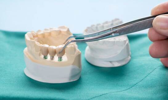 Jak długo trwa proces wstawiania implantów?