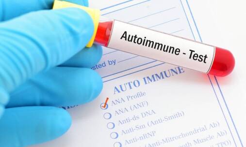 Immunologiczne przyczyny przewlekłego zmęczenia – co warto wiedzieć?