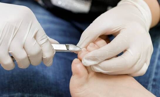 Jak podolog radzi sobie z wkręcającymi się paznokciami?