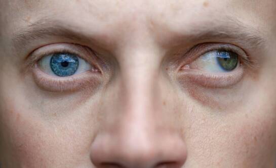 Jakie są najczęstsze wady wzroku diagnozowane u niemowląt?