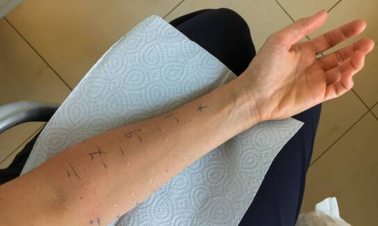 Alergologia dziecięca w Lar-Med Niepubliczny Zakład Opieki Zdrowotnej