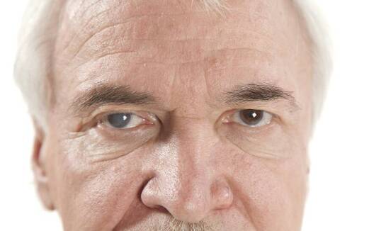 Jakie są pierwsze objawy jaskry?