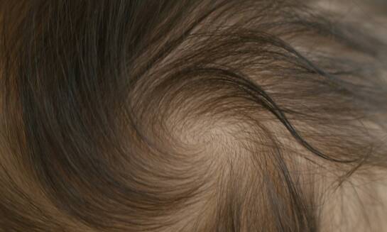 Mikropigmentacja skóry głowy – salon TomHair