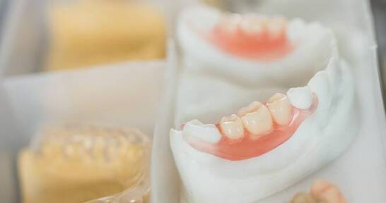 Mosty dentystyczne a estetyka uśmiechu – jak wpływają na wygląd?