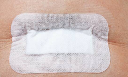 Co warto wiedzieć o procesie gojenia po zabiegach chirurgicznych w jamie ustnej?