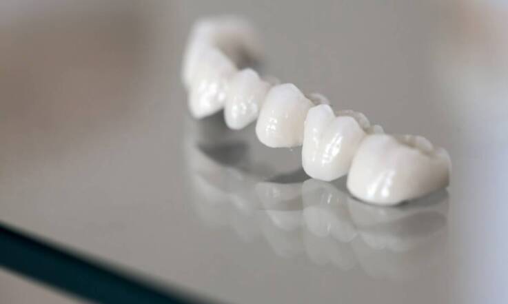 Jakie funkcje pełnią korony protetyczne i kiedy warto się na nie zdecydować?