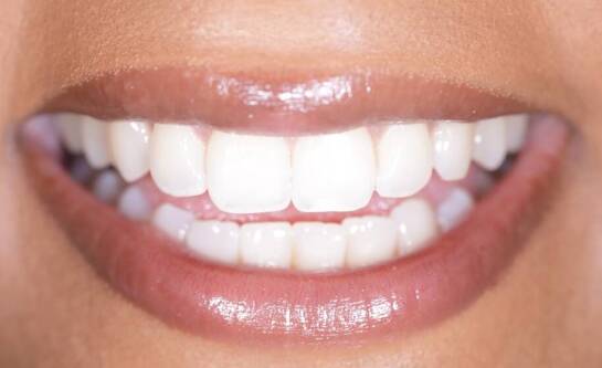 Jak długo utrzymuje się efekt wybielania zębów?