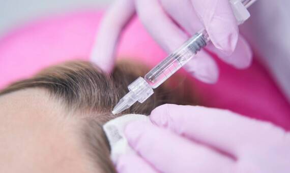 Przeszczep włosów metodą FUE a proces regeneracji skóry głowy