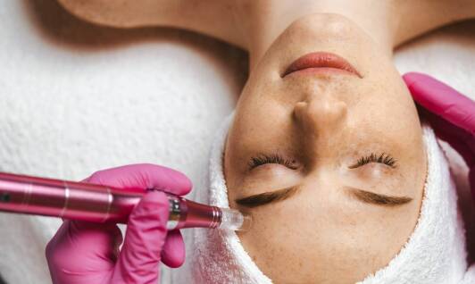 Mezoterapia mikroigłowa a pielęgnacja skóry: jak dbać o efekty zabiegu?