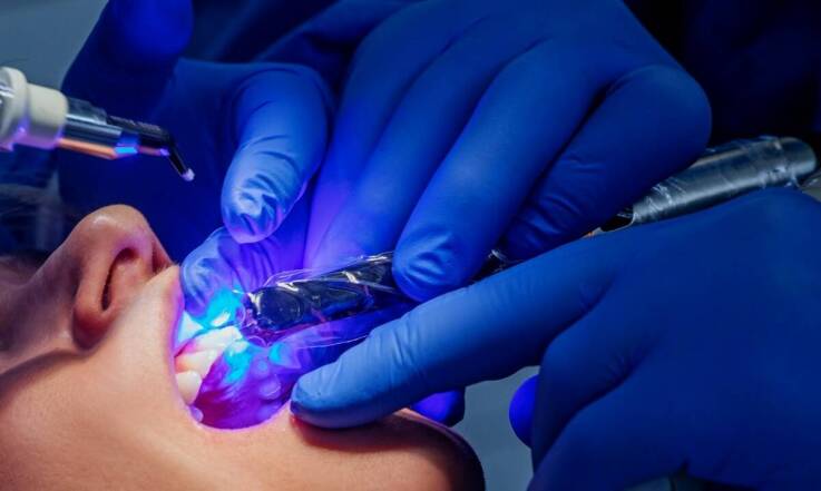 Nowoczesne metody wybielania zębów oferowane przez dentystę w Kórniku pod Poznaniem