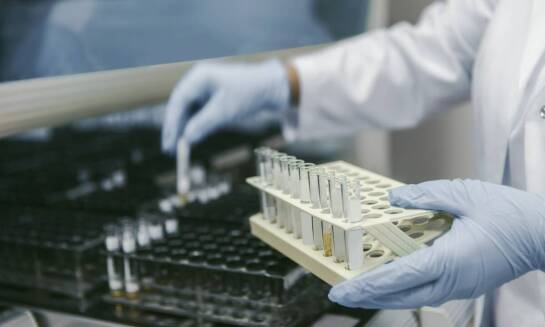 Innowacyjne rozwiązania w konstrukcji pojemników do badania moczu