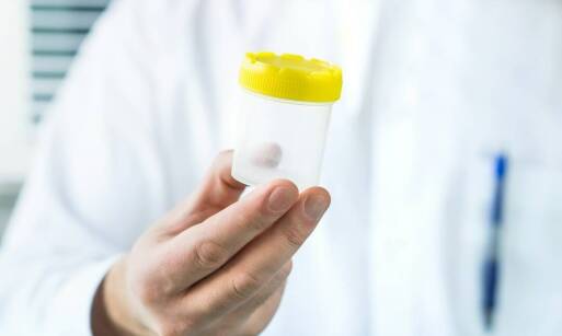 Czym różni się sterylny pojemnik na mocz od niesterylnego?