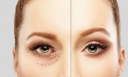 Bezpieczeństwo i efekty plastyki powiek – co gwarantuje sukces?