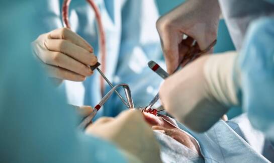 Jakie są najczęstsze wyzwania związane ze zdejmowaniem szwów?