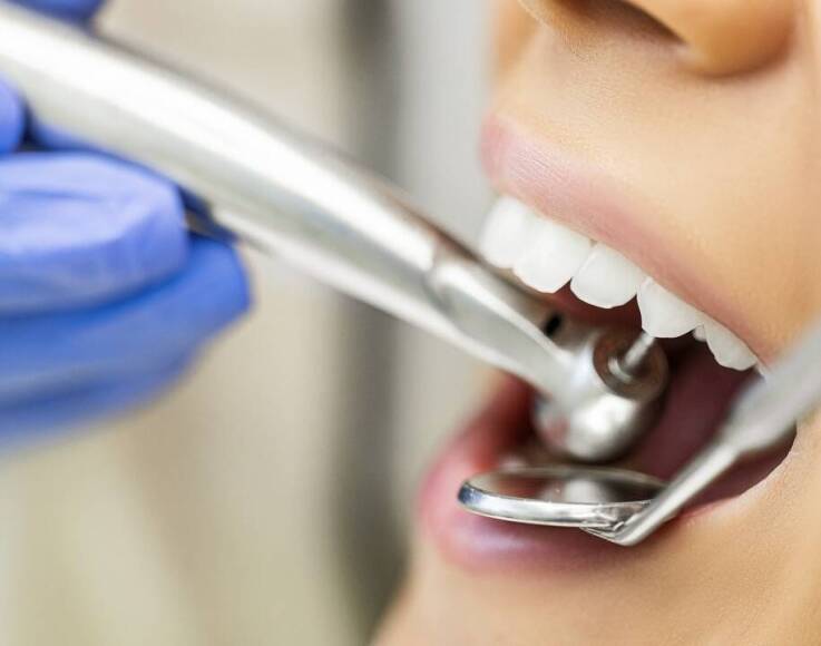 Jakie są różnice między tradycyjnymi a nowoczesnymi wypełnieniami zębów?