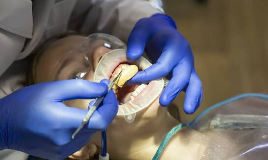 Jakie są różnice między domowymi a profesjonalnymi metodami wybielania zębów?