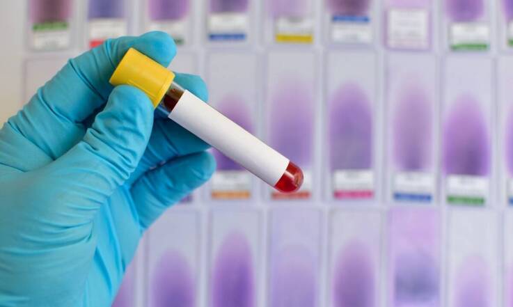 Znaczenie hematologii w monitorowaniu stanu zdrowia Twojego pupila