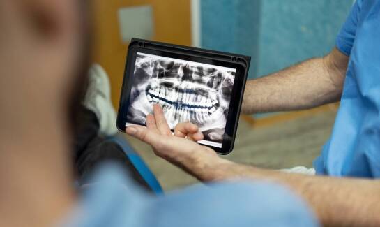 Rentgen zębów a dokładność diagnozy stomatologicznej
