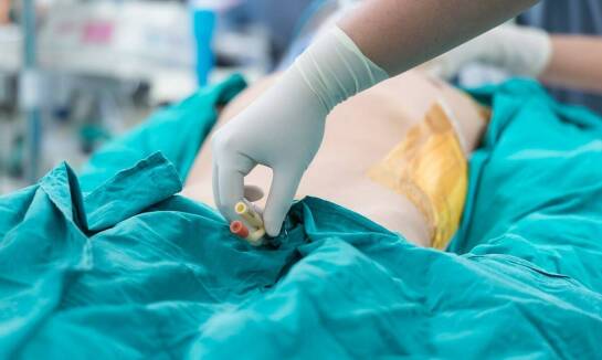 Jakie są kluczowe aspekty opieki nad pacjentami z PEG?