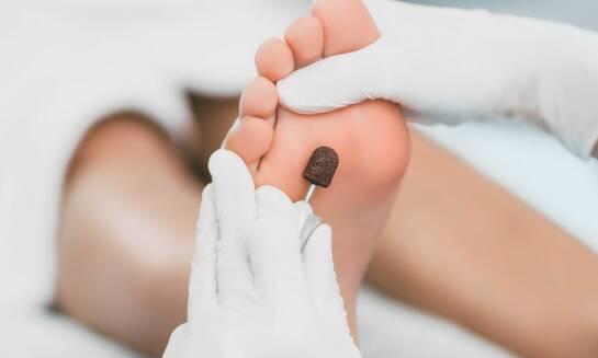 Jak centrum podologiczne radzi sobie z odciskami?