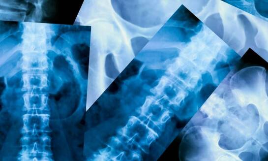 Porównanie RTG kręgosłupa lędźwiowego z innymi metodami diagnostycznymi