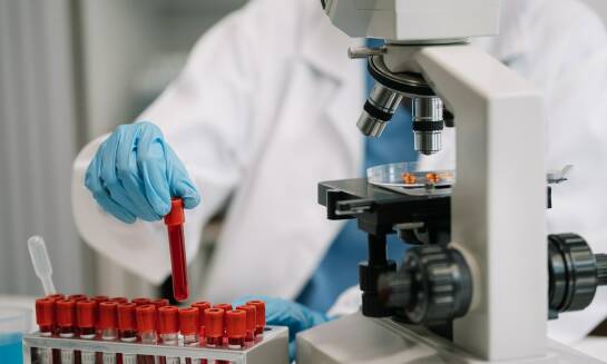 Wirówki do osocza: co warto wiedzieć o ich konserwacji i serwisie