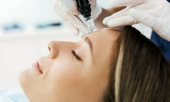 Dermapen jako metoda poprawy struktury skóry
