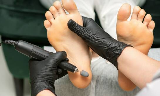 Efektywność technik pedicure w usuwaniu zrogowaciałego naskórka
