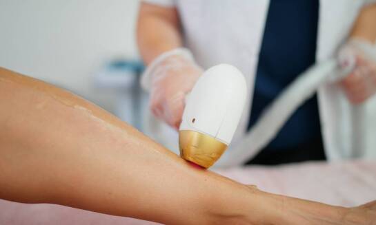 Jak epilacja laserowa może pomóc osobom z wrażliwą skórą?