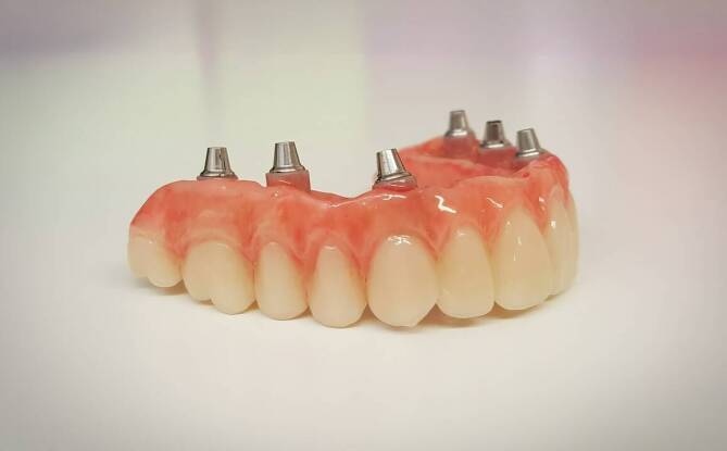 Zalety protez wykonanych z materiałów termoplastycznych w codziennym użytkowaniu