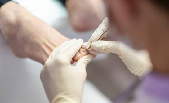 Usuwanie modzeli a poprawa jakości życia pacjentów z problemami stóp