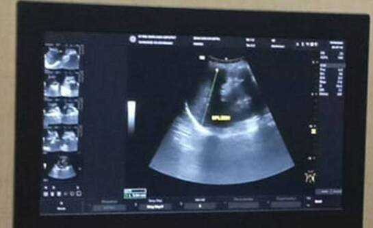 Świadczenia dla kobiet w ciąży bez pracy w 2025 roku