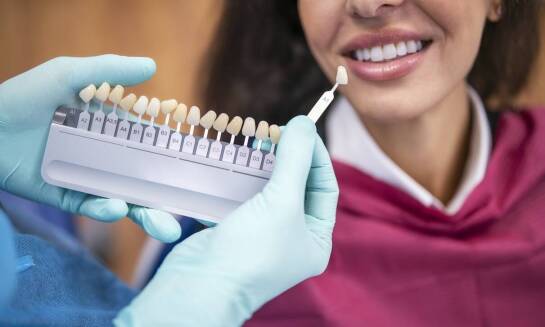 Licówki porcelanowe a poprawa koloru zębów