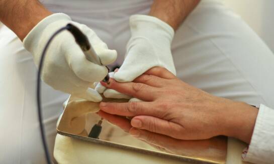 Specjalistyczne podejście do leczenia paznokci dystroficznych