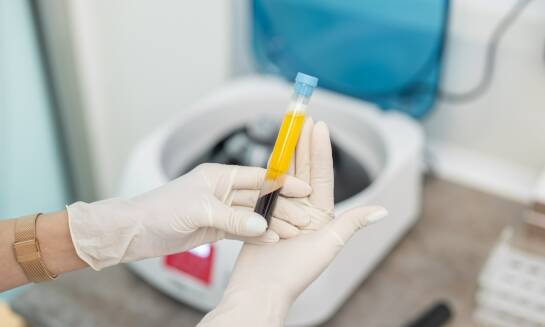 Wirówka do i-PRF: jak wybrać odpowiedni model dla swojej kliniki?