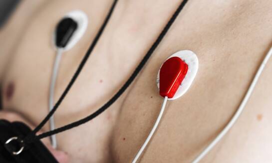 Spoczynkowe badanie EKG: kluczowy element profilaktyki chorób sercowych