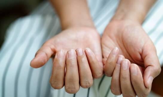 Jakie są najczęstsze objawy chorobowo zmienionych paznokci, które wymagają wizyty u specjalisty?