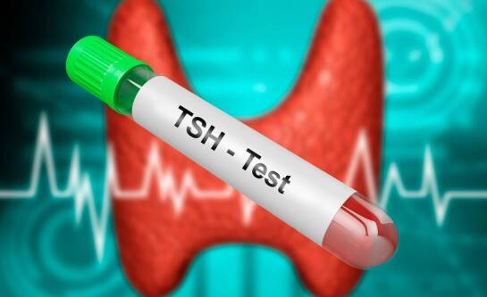 Badanie krwi TSH – co to jest i kiedy się je wykonuje