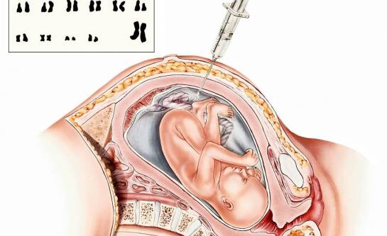 Wielowodzie w ciąży – przyczyny, objawy i możliwe zagrożenia