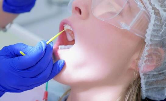 Na czym polega lakierowanie zębów?