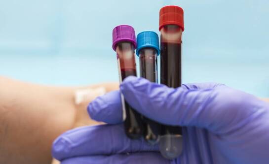 Jakie badania wykonuje się podczas oddawania krwi