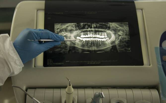 Jak dobrać odpowiednie implantologiczne rozwiązania do indywidualnych potrzeb pacjenta?