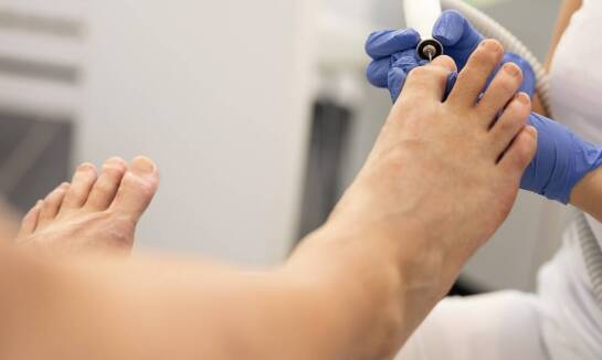 Jak długo trzeba nosić klamry na wrastające paznokcie?