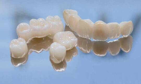 Jakie są różnice między różnymi rodzajami zębowych mostów?