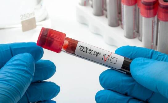 Kiedy należy wykonać test PCR?