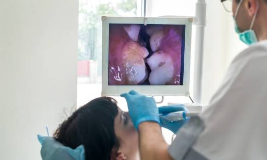 Jak leczenie kanałowe mikroskopowe wpłynęło na rozwój stomatologii?