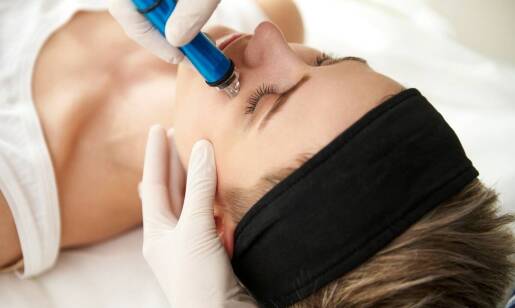 Jak przebiega zabieg mikroigłowej mezoterapii krok po kroku?