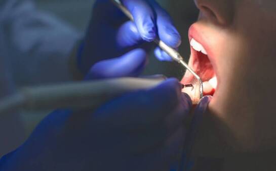 Dlaczego warto rozpocząć leczenie u specjalisty w zakresie periodontologii?
